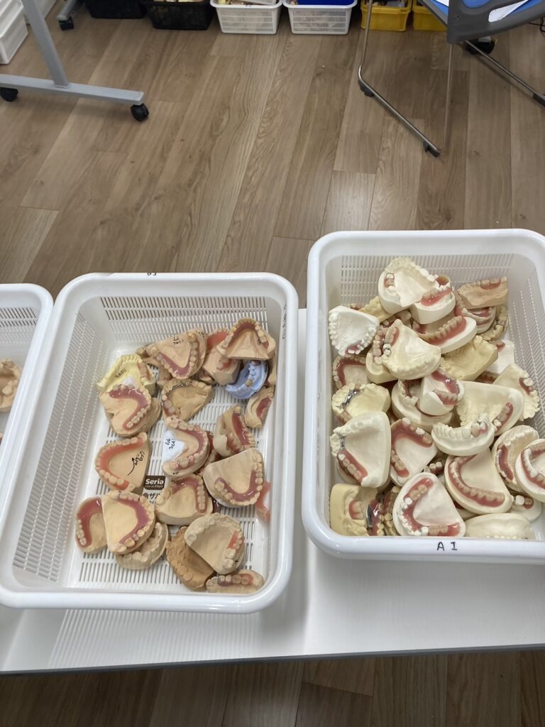 複数の入れ歯の写真