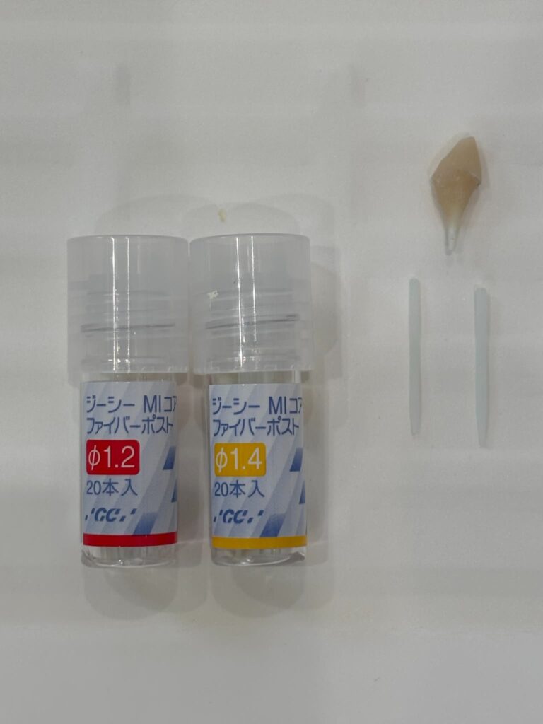 ファイバーポスト